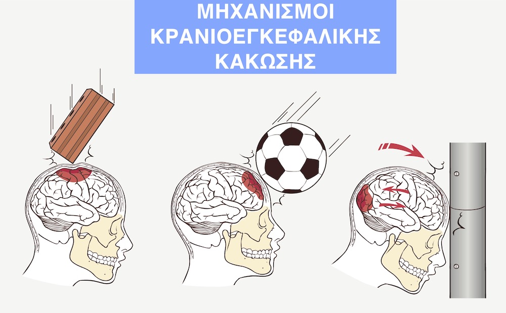 Μηχανισμοί κρανιοεγκεφαλικής κάκωσης, τραυματισμού κρανίου και εγκεφάλου