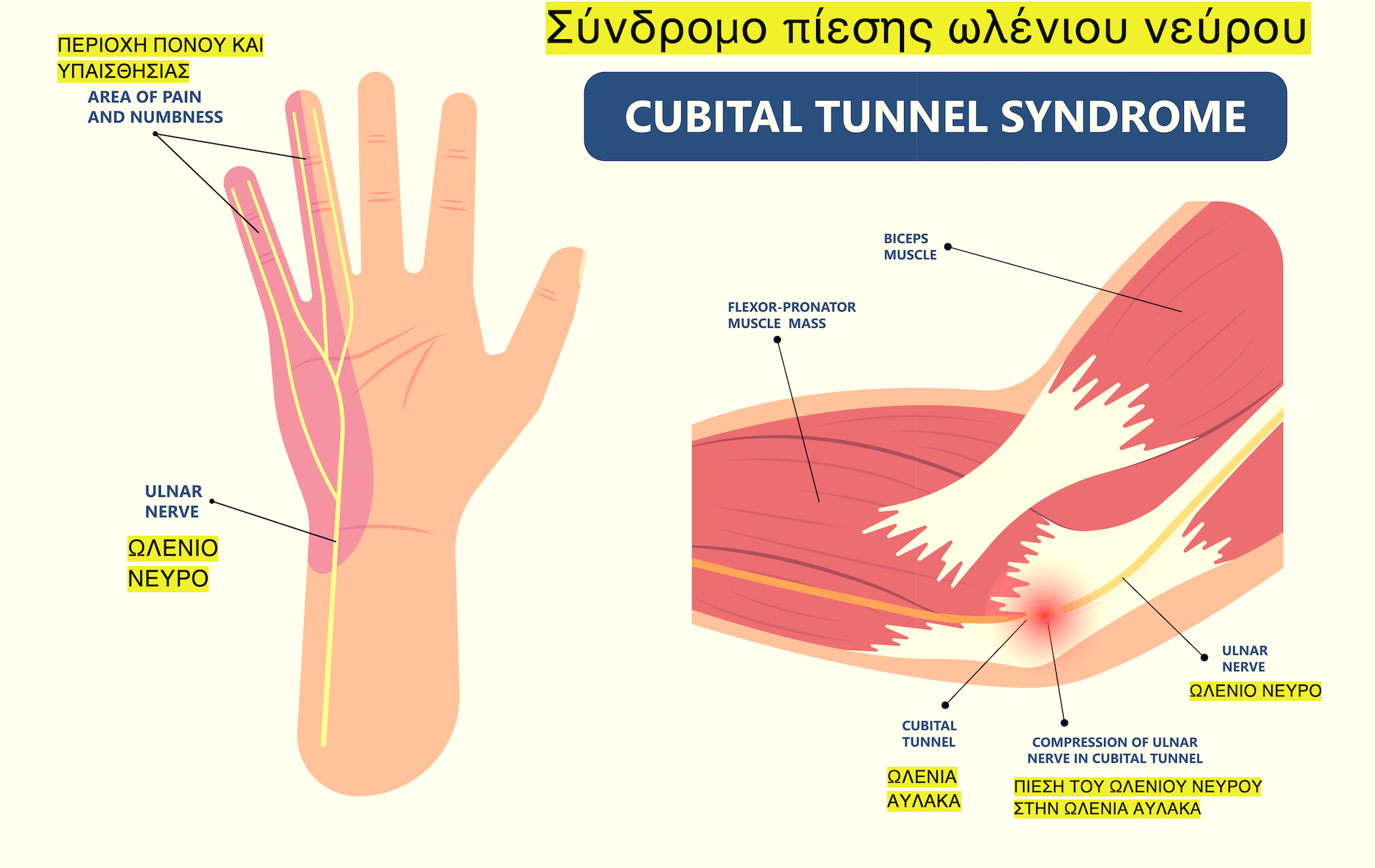 ulnarnerve